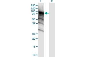 Western Blot analysis of DDX4 expression in transfected 293T cell line by DDX4 monoclonal antibody (M06), clone 3D5. (DDX4 抗体  (AA 625-724))