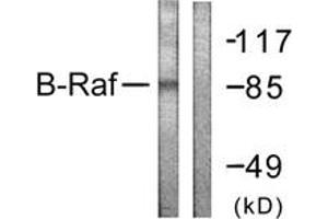 Western Blotting (WB) image for anti-B-Raf proto-oncogene, serine/threonine kinase (BRAF) (AA 576-625) antibody (ABIN2888763) (BRAF 抗体  (AA 576-625))