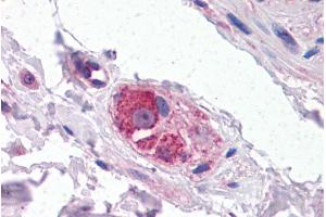 Immunohistochemistry (IHC) image for anti-Cytochrome P450, Family 26, Subfamily B, Polypeptide 1 (CYP26B1) (Internal Region) antibody (ABIN185731)