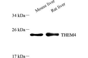 Western blot analysis of THEM4 (ABIN7075881),at dilution of 1: 600 (THEM4 抗体)