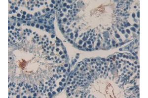 DAB staining on IHC-P; Samples: Mouse Testis Tissue (RANKL 抗体  (AA 92-263))
