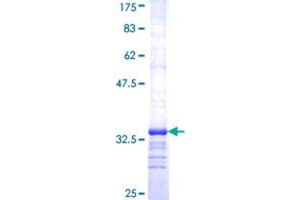 SV2A Protein (AA 474-530) (GST tag)