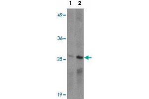 Western blot analysis of CD244 in Daudi cell lysate with CD244 polyclonal antibody  at (1) 1 and (2) 2 ug/mL. (2B4 抗体  (C-Term))