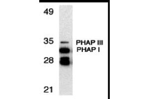 Western Blotting (WB) image for anti-Acidic (Leucine-Rich) Nuclear phosphoprotein 32 Family, Member A/B (ANP32A/ANP32B) (C-Term) antibody (ABIN1030577) (PHAP 抗体  (C-Term))
