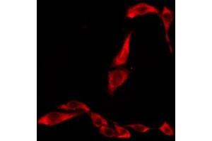 ABIN6276277 staining Hela by IF/ICC. (TAS2R45 抗体)