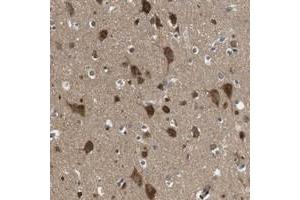 Immunohistochemical staining of human cerebral cortex with FAM69A polyclonal antibody  shows strong cytoplasmic positivity in neuronal cells. (FAM69A 抗体)