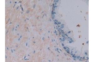 Immunohistochemistry (IHC) image for anti-Ferritin, Light Polypeptide (FTL) (AA 2-175) antibody (ABIN7435310)