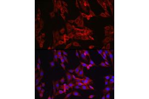 Immunofluorescence (IF) image for anti-Cyclin B1 (CCNB1) (C-Term) antibody (ABIN3022807)