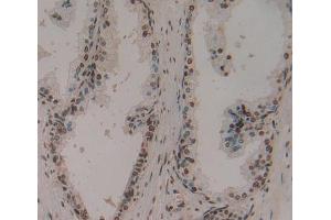 IHC-P analysis of Human Tissue, with DAB staining. (Ephrin A1 抗体  (AA 19-182))