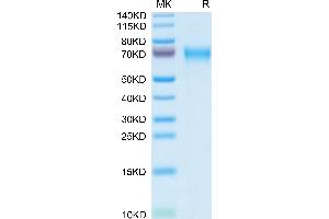 LCAT Protein (AA 25-438) (His tag)