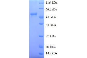 SDS-PAGE (SDS) image for Myc Proto-Oncogene protein (MYC) (AA 1-439), (full length) protein (His tag) (ABIN5709983) (c-MYC Protein (AA 1-439, full length) (His tag))