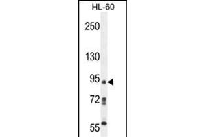 KRI1 Antibody (N-term) (ABIN654199 and ABIN2844048) western blot analysis in HL-60 cell line lysates (35 μg/lane). (KRI1 抗体  (N-Term))