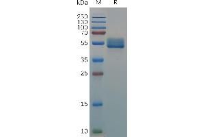 SDS-PAGE (SDS) image for Interleukin 18 Binding Protein (IL18BP) (AA 31-192) protein (Fc Tag) (ABIN7490683)
