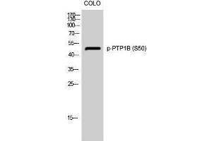 Western Blotting (WB) image for anti-Protein tyrosine Phosphatase, Non-Receptor Type 1 (PTPN1) (pSer50) antibody (ABIN3182605) (PTPN1 抗体  (pSer50))