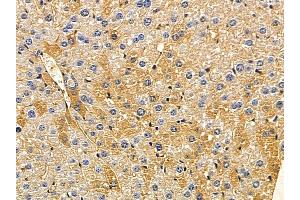 ABIN7094076 and ABIN7098120 at 1/100 staining mouse liver tissue by IHC-P. (ARMC10 抗体  (Internal Region))