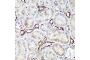 Immunohistochemistry of paraffin-embedded rat kidney using CASR antibody (ABIN1678994, ABIN5663902, ABIN5663904 and ABIN6218520) at dilution of 1:50 (40x lens). (CASR 抗体  (AA 874-1088))