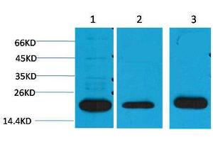 Western Blotting (WB) image for anti-Periaxin (PRX) antibody (ABIN3179015) (Periaxin 抗体)