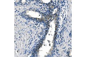 IHC analysis of ASS1 using anti-ASS1 antibody (ABIN7601191). (ASS1 抗体  (AA 3-365))