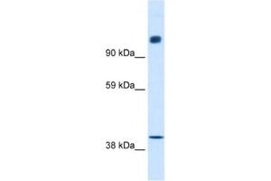 Western Blotting (WB) image for anti-Nuclear Receptor Co-Repressor 1 (NCOR1) antibody (ABIN2460482) (NCOR1 抗体)