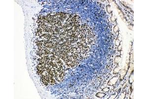 Immunohistochemistry (IHC) image for anti-Minichromosome Maintenance Complex Component 2 (MCM2) (AA 884-904) antibody (ABIN3031803)
