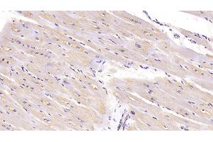 Detection of CTGF in Human Cardiac Muscle Tissue using Monoclonal Antibody to Connective Tissue Growth Factor (CTGF) (CTGF 抗体  (AA 80-200))
