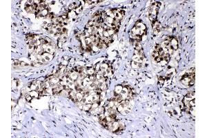 Immunohistochemistry (IHC) image for anti-RAN, Member RAS Oncogene Family (RAN) (AA 2-216) antibody (ABIN5518950)