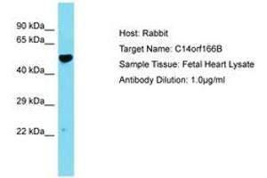 Image no. 1 for anti-Chromosome 14 Open Reading Frame 166B (C14ORF166B) (AA 26-75) antibody (ABIN6750760) (C14orf166B 抗体  (AA 26-75))