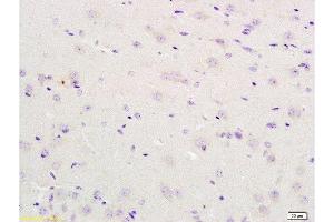 Immunohistochemistry (Paraffin-embedded Sections) (IHC (p)) image for anti-Interleukin 12 Receptor, beta 2 (IL12RB2) (AA 301-400) antibody (ABIN747878)