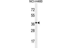 Western Blotting (WB) image for anti-Zinc Finger CCCH-Type Containing 15 (ZC3H15) (AA 370-399), (C-Term) antibody (ABIN955636)