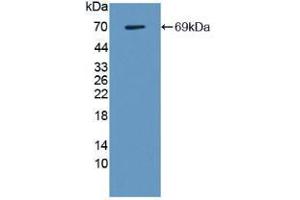 Image no. 3 for Lectin, Galactoside-Binding, Soluble, 9 (LGALS9) (AA 1-355) (Active) protein (His tag,GST tag) (ABIN6239815) (Galectin 9 Protein (AA 1-355) (His tag,GST tag))