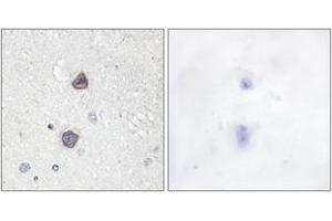 Immunohistochemistry analysis of paraffin-embedded human brain, using Aquaporin 2 (Phospho-Ser256) Antibody. (AQP2 抗体  (pSer256))