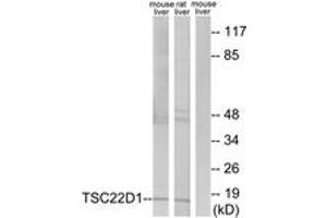 Western blot analysis of extracts from mouse liver/rat liver cells, using TSC22D1 Antibody. (TSC22D1 抗体  (AA 71-120))