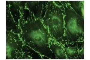 Immunostaining of primary RPE cells with CX43 Ab at 1/100 dilution. (Connexin 43/GJA1 抗体  (C-Term))