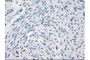 Image no. 3 for anti-Signal Transducer and Activator of Transcription 1, 91kDa (STAT1) antibody (ABIN1501169)