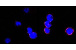 Confocal immunofluorescence analysis of BCBL-1 cells (left) and L1210 cells (right) using CD18 mouse mAb (red). (Integrin beta 2 抗体)