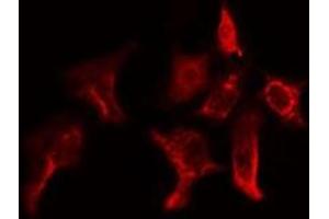 ABIN6275155 staining Hela cells by IF/ICC. (GSTT1 抗体  (N-Term))