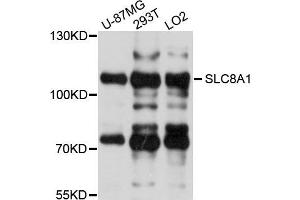 Western blot analysis of extracts of various cells, using SLC8A1 antibody. (SLC8A1 抗体)