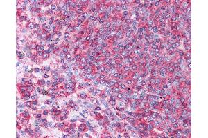 HSPA8 antibody was used for immunohistochemistry at a concentration of 4-8 ug/ml. (Hsc70 抗体  (N-Term))