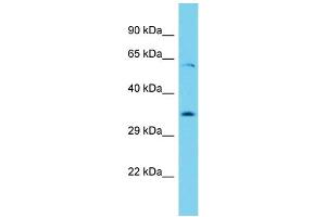 Host: Rabbit Target Name: Ythdf1 Sample Type: Rat Thymus lysates Antibody Dilution: 1. (YTHDF1 抗体  (N-Term))