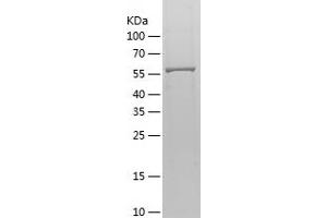 Western Blotting (WB) image for Mesothelin (MSLN) (AA 37-598) protein (His tag) (ABIN7123919)