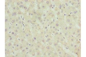 Immunohistochemistry of paraffin-embedded human liver tissue using ABIN7142596 at dilution of 1:100 (ALAS2 抗体  (AA 50-587))