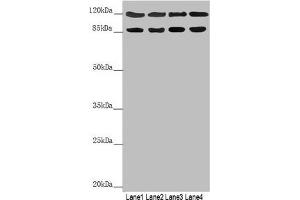 Western blot All lanes: SCYL1 antibody at 3. (SCYL1 抗体  (AA 460-740))
