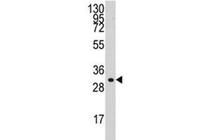 Western blot analysis of Cyclin C antibody and HL-60 lysate. (Cyclin C 抗体  (AA 221-249))