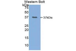 Western blot analysis of the recombinant protein. (Merlin 抗体  (AA 30-311))
