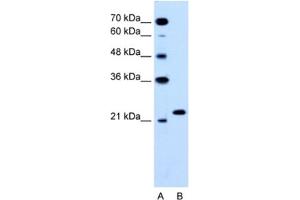 Western Blotting (WB) image for anti-RAB14, Member RAS Oncogene Family (RAB14) antibody (ABIN2463772) (RAB14 抗体)