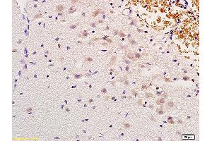 Formalin-fixed and paraffin embedded rat brain labeled with Anti-MSH gamma Polyclonal Antibody, Unconjugated (ABIN751123) at 1:200 followed by conjugation to the secondary antibody and DAB staining (gamma MSH (AA 51-150) 抗体)