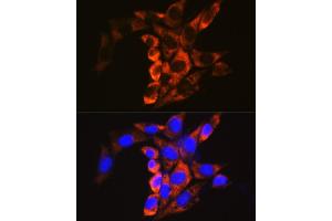 Immunofluorescence analysis of NIH/3T3 cells using Calpain 1 antibody (ABIN3021622, ABIN3021623, ABIN3021624, ABIN1512666 and ABIN6215416) at dilution of 1:100. (CAPNL1 抗体  (AA 20-330))