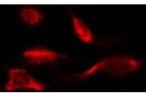 ABIN6278062 staining HepG2 by IF/ICC. (Ferredoxin1 (FDX1) (Internal Region) 抗体)