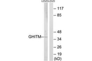 Western Blotting (WB) image for anti-Growth Hormone Inducible Transmembrane Protein (GHITM) (AA 31-80) antibody (ABIN2890353) (GHITM 抗体  (AA 31-80))