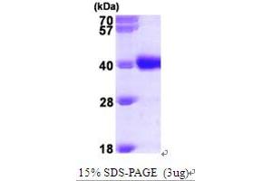 SDS-PAGE (SDS) image for UDP-Galactose-4-Epimerase (GALE) (AA 1-348) protein (His tag) (ABIN667033) (GALE Protein (AA 1-348) (His tag))